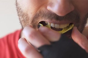 a man wearing a mouthguard to protect dental implants