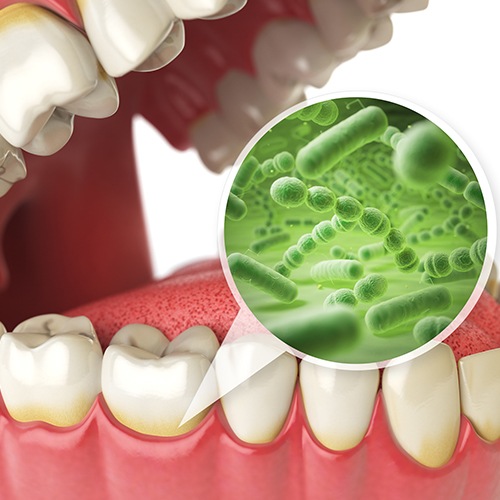 Animated smile and enlarged bacteria representing the dangers of gum disease