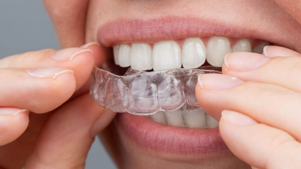 A woman removing her clear aligners.